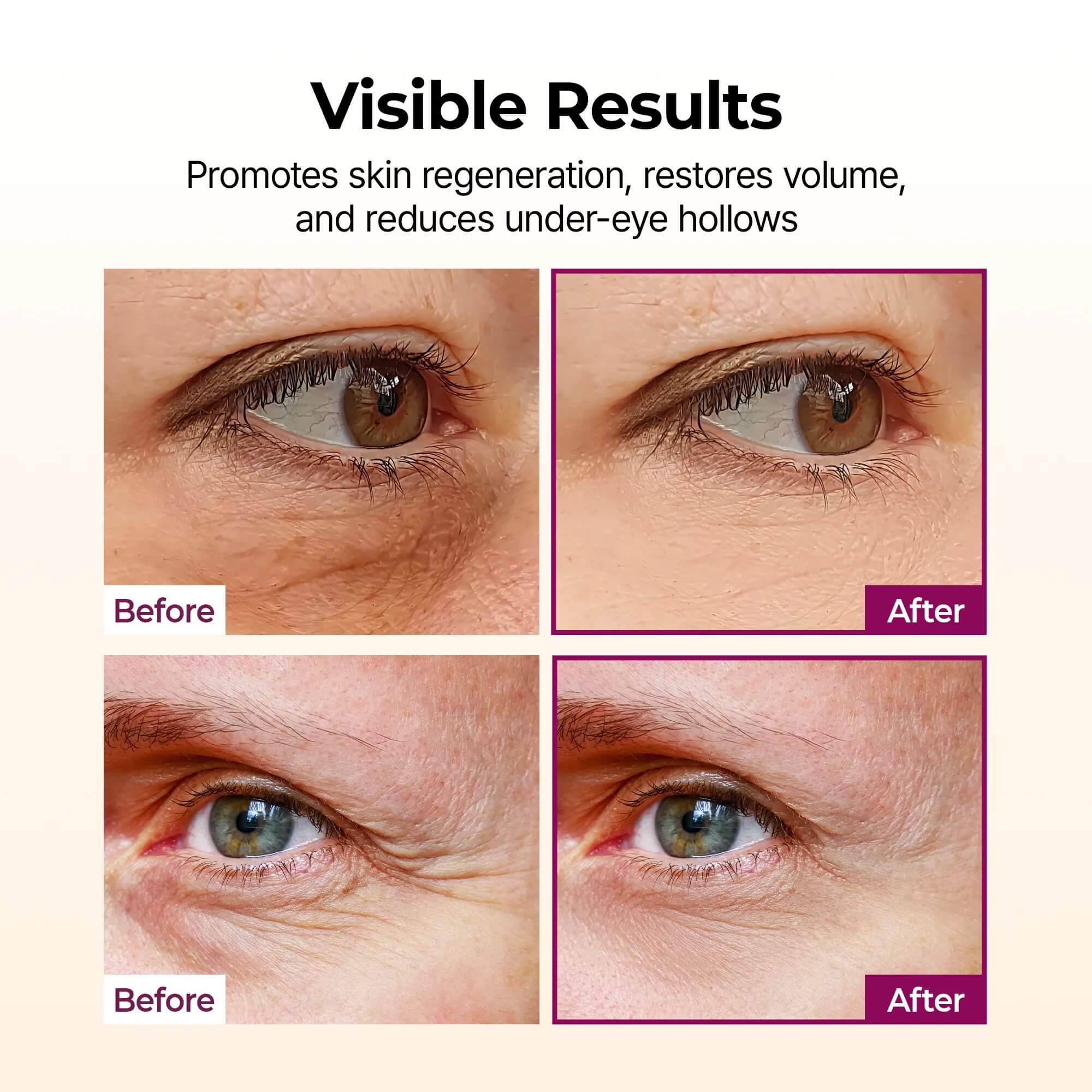 Calcium Volume Multi Balm with Collagen for Wrinkles & Fine Lines