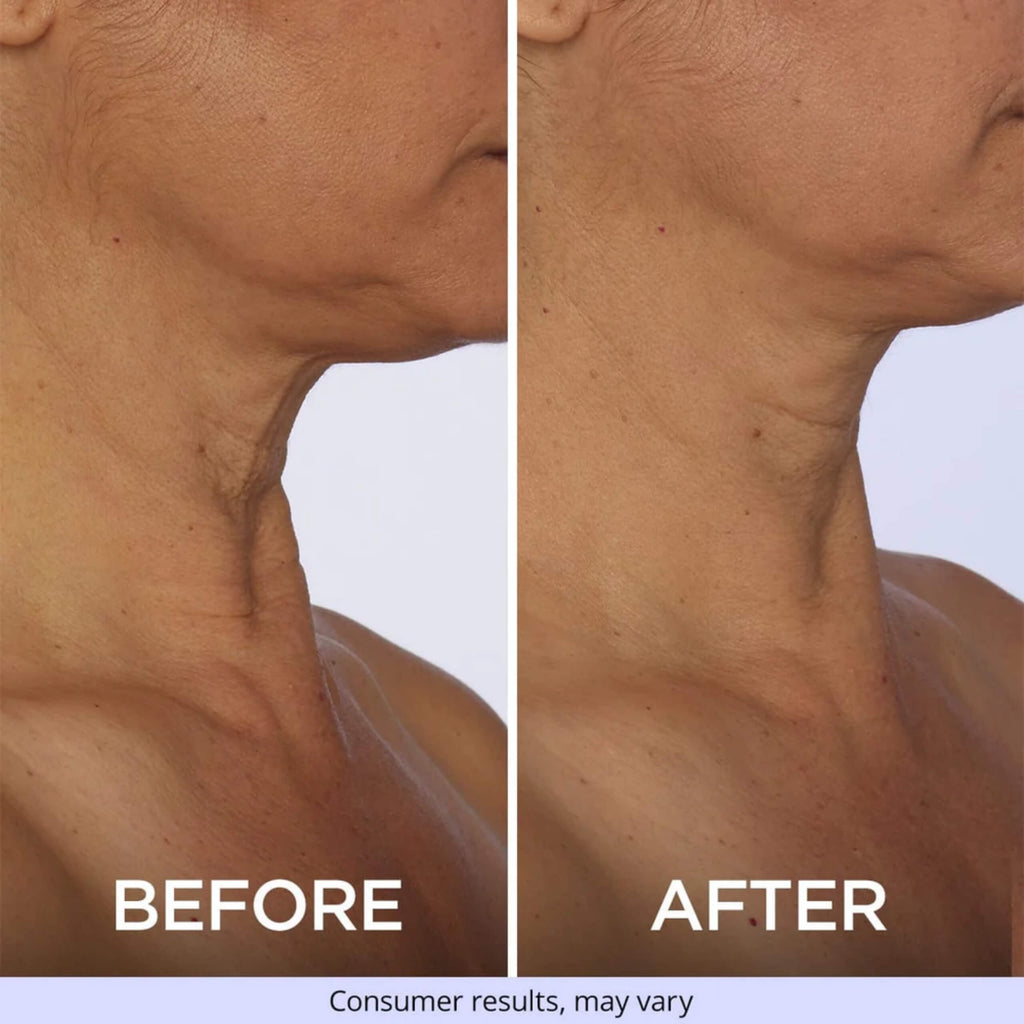 Tighten & Lift Neck Cream