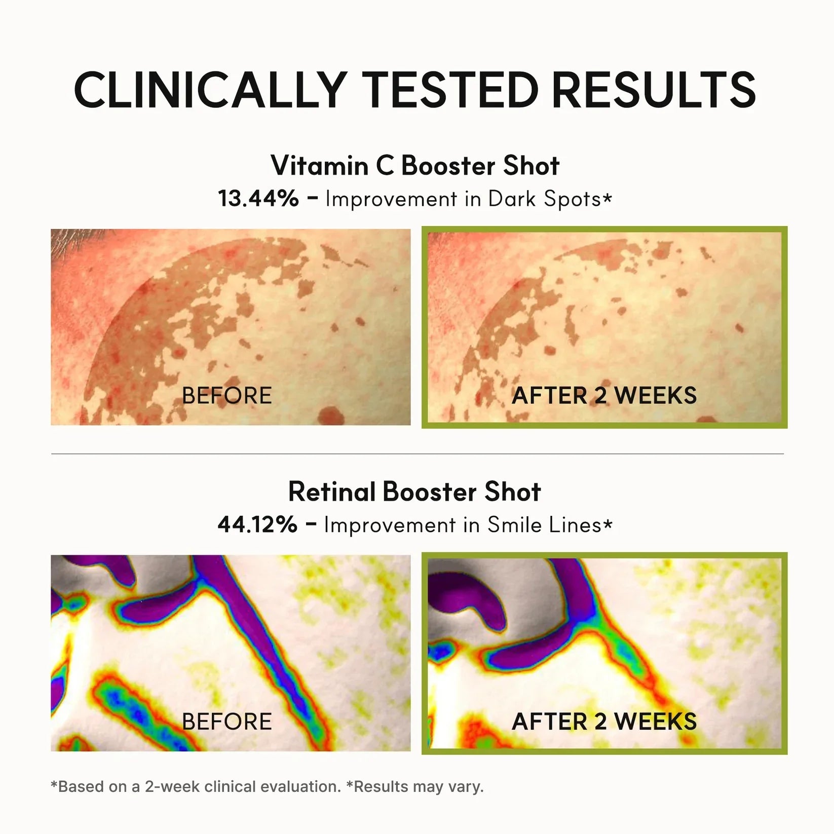 Findglee Booster Shot Vitamin C & Retinal Duo for Dark Spots, Pores & Blemishes
