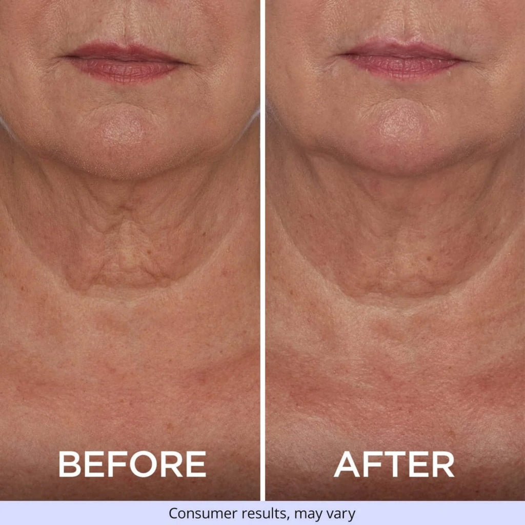 Tighten & Lift Neck Cream