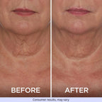 Tighten & Lift Neck Cream