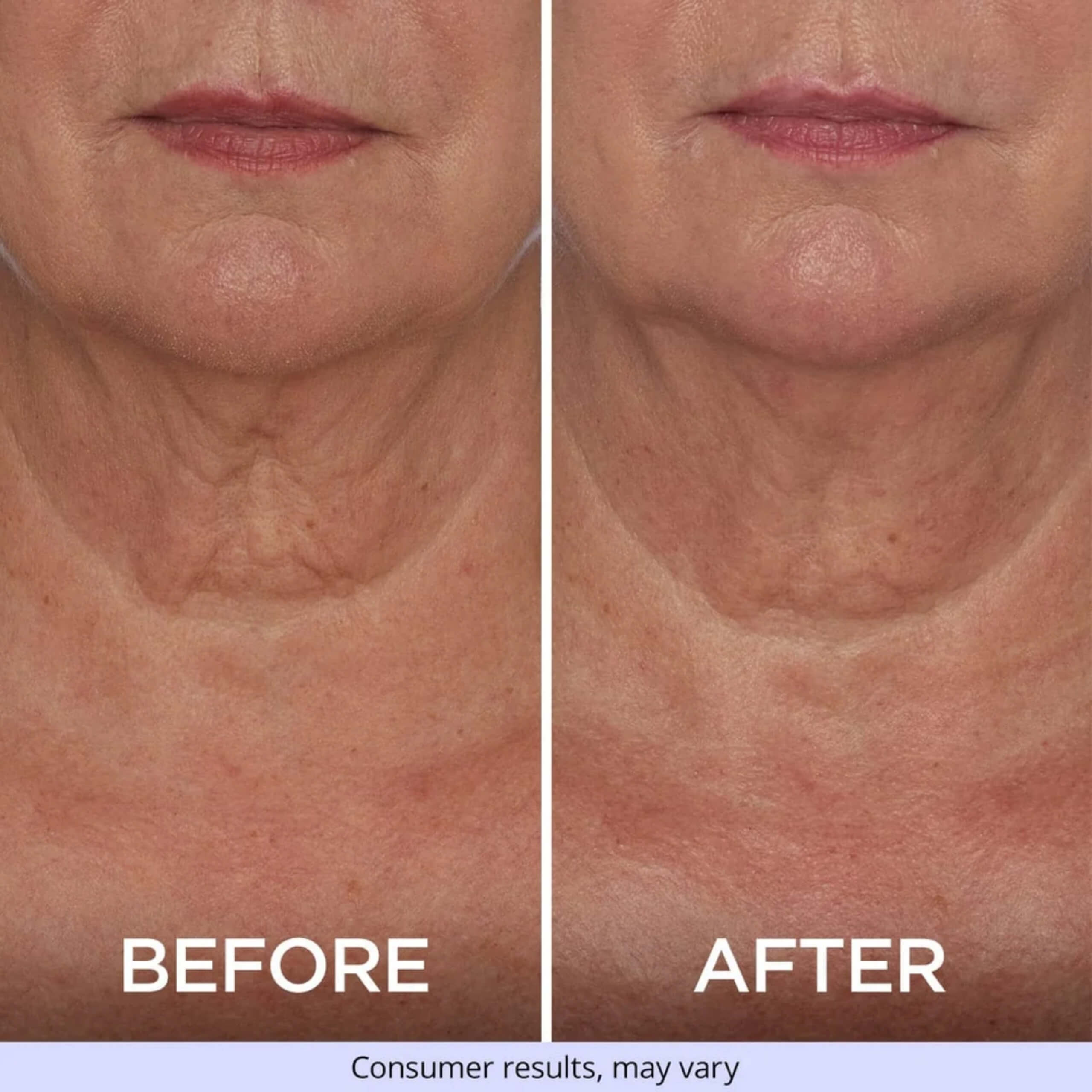 Tighten & Lift Neck Cream