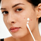 Findglee Salicylic Acid Drying Lotion with Niacinamide, Sulfur & Zinc Oxide for Acne