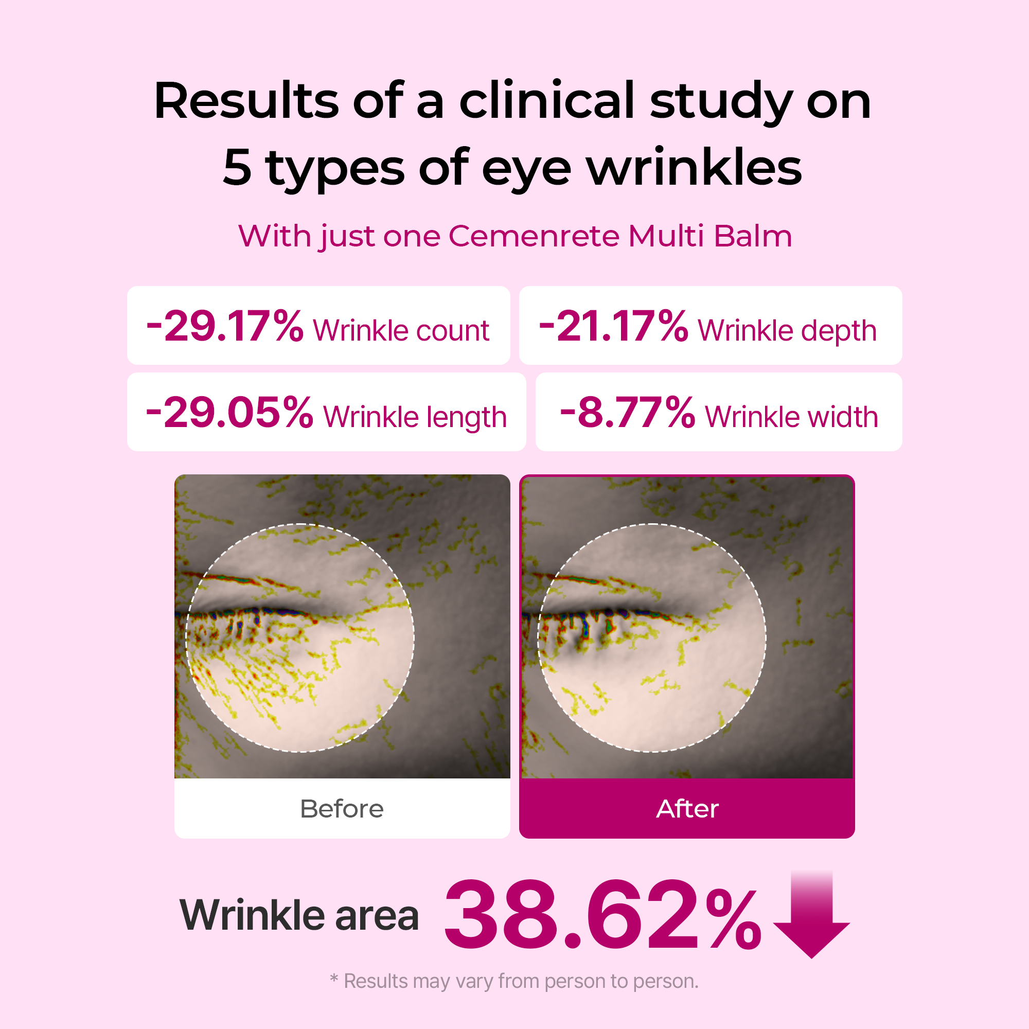 Findglee Cemenrete Calcium Volume Multi Balm with Collagen for Wrinkles & Fine Lines