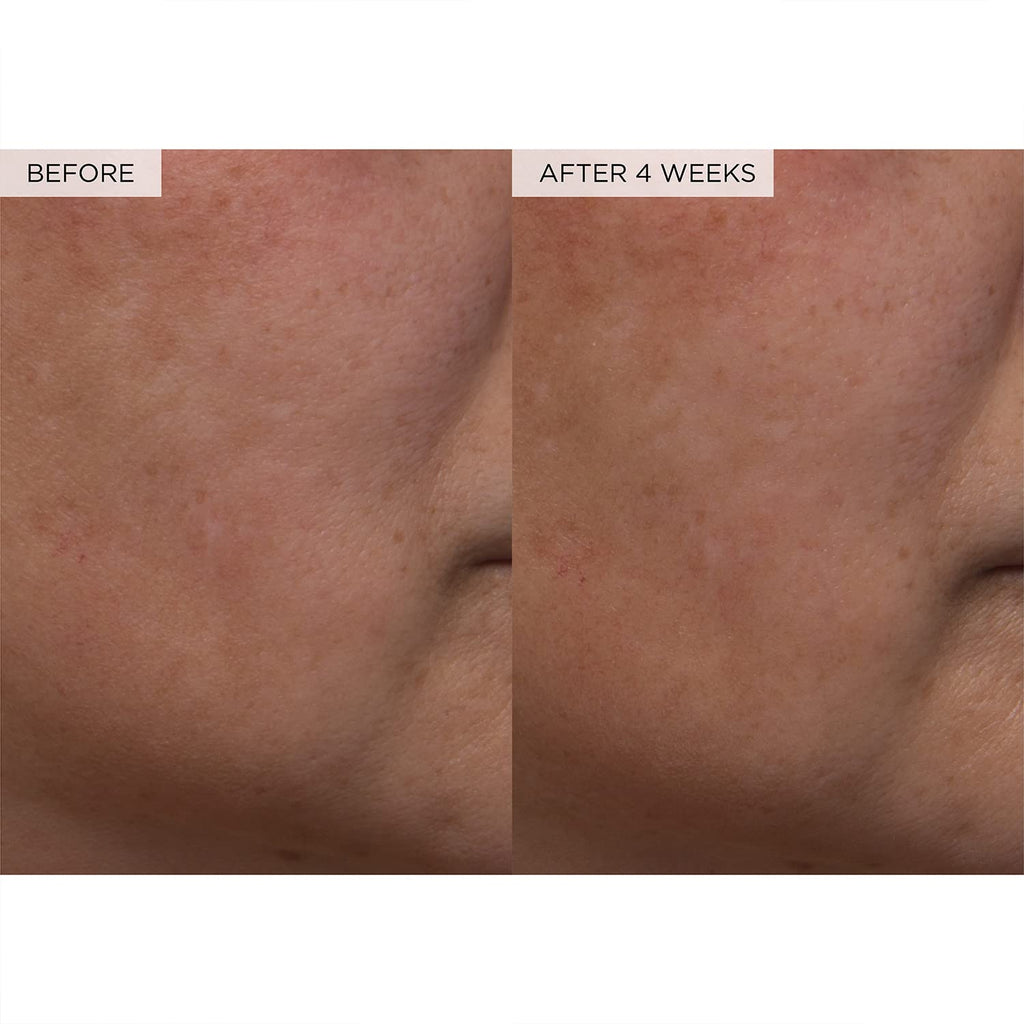 Findglee PHA + BHA Pore Tight Toner with Watermelon Extract & Glycerin for Pore