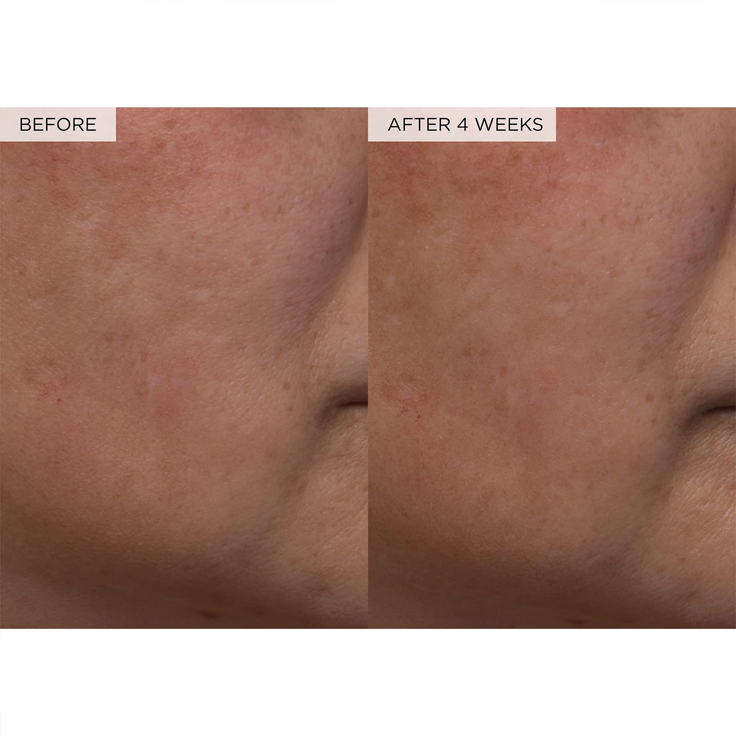 Findglee PHA + BHA Pore Tight Toner with Watermelon Extract & Glycerin for Pore