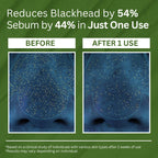 Findglee Holy Basil Bubble Deep Mask with Korean Clay & PHA for Pores, Blackheads & Blemishes