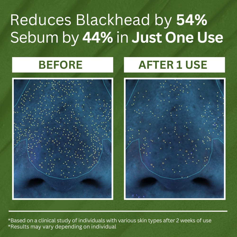 Findglee Holy Basil Bubble Deep Mask with Korean Clay & PHA for Pores, Blackheads & Blemishes