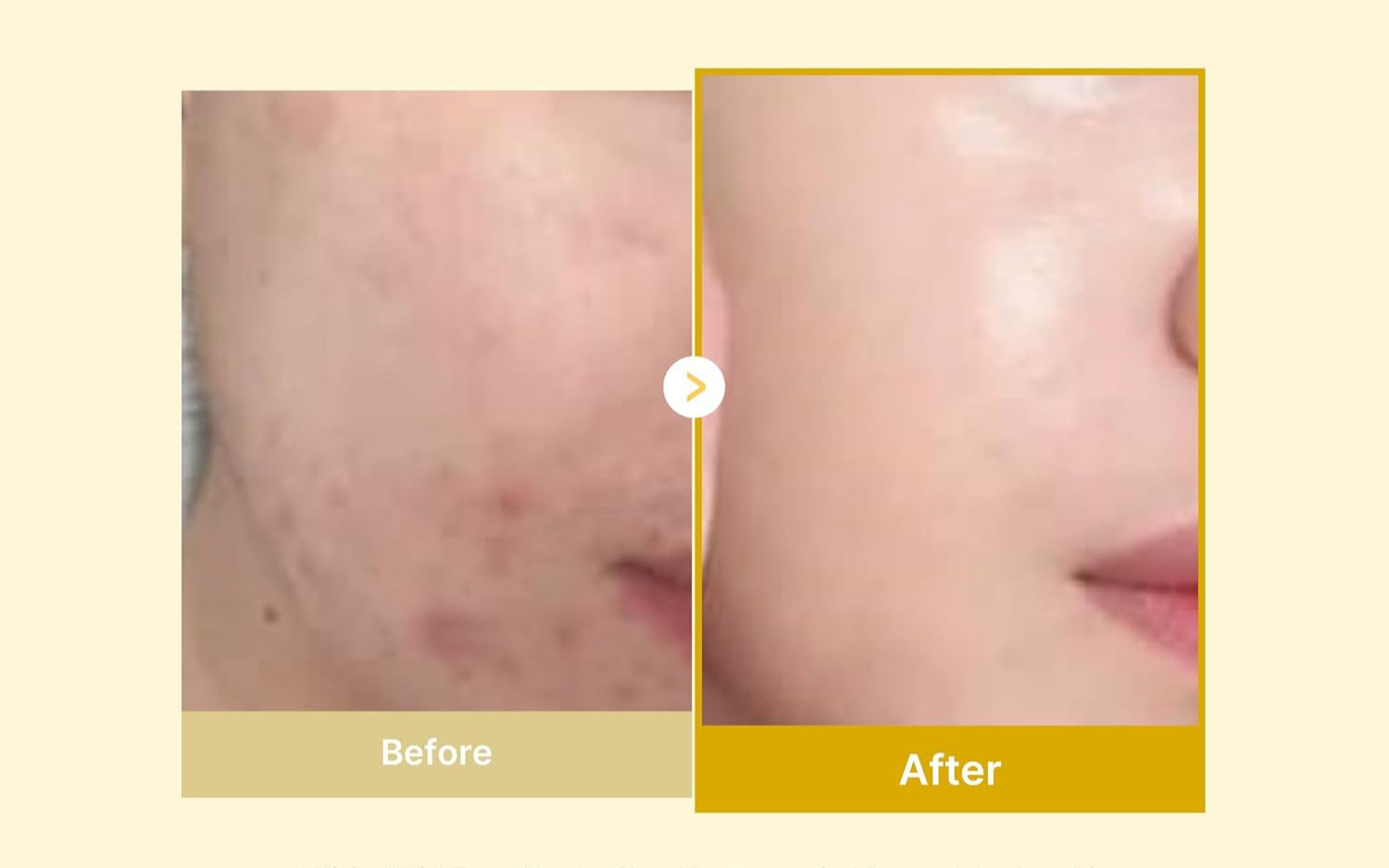 Findglee Kojic Acid & Turmeric Overnight Peel-Off Mask featuring Vitamin C & Retinol