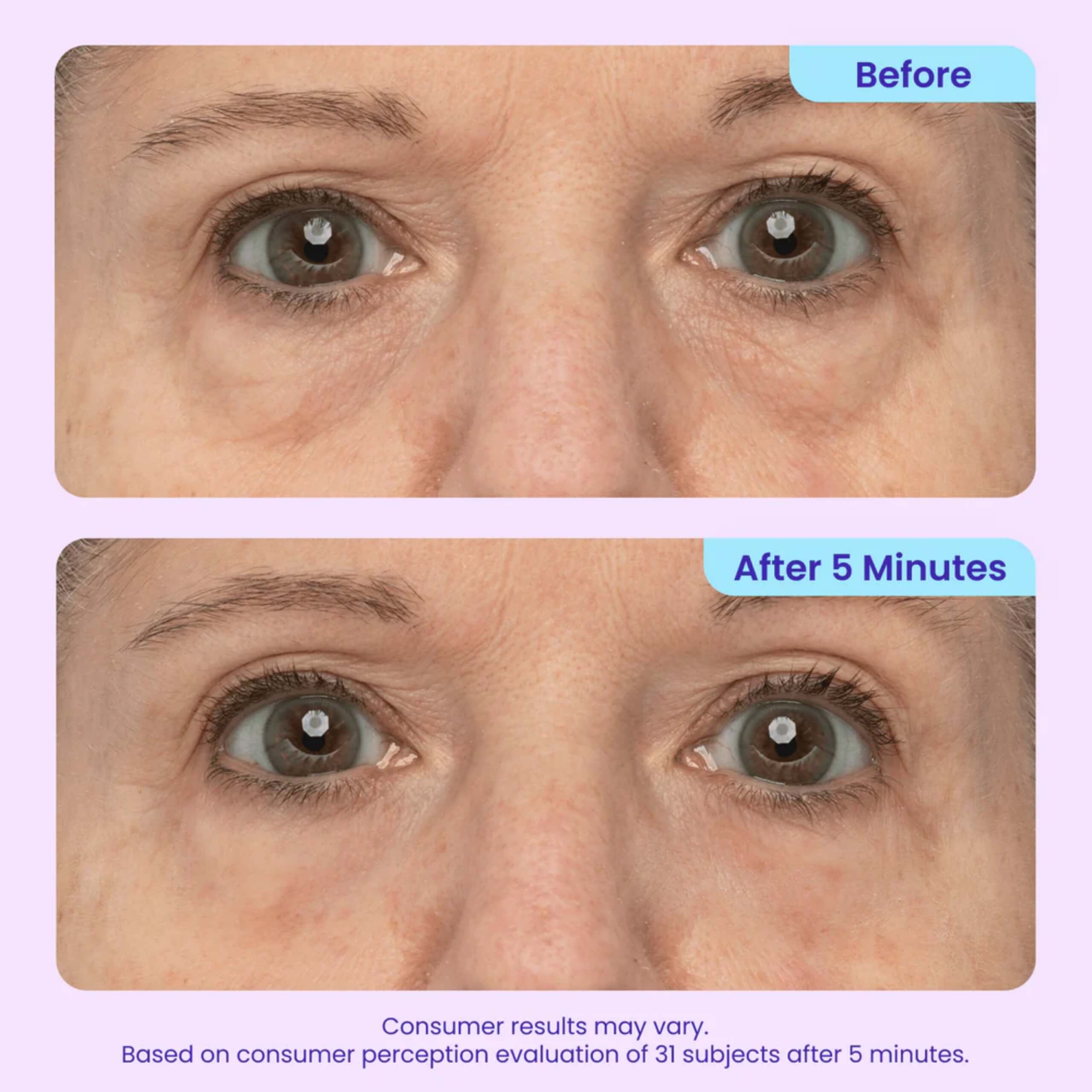 Instant Lift Eye Gel