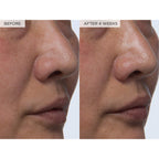 Findglee PHA + BHA Pore Tight Toner with Watermelon Extract & Glycerin for Pore
