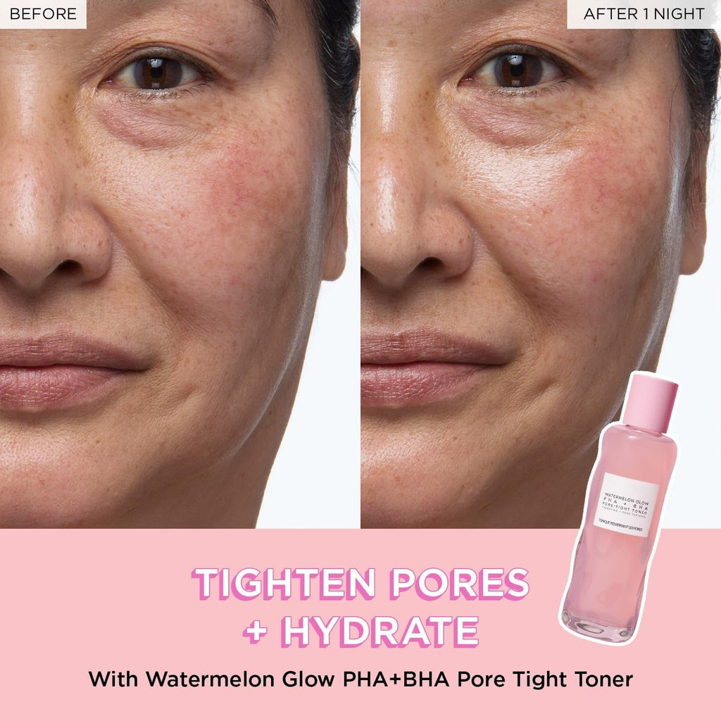 Findglee PHA + BHA Pore Tight Toner with Watermelon Extract & Glycerin for Pore