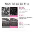 Findglee Rosemary PDRN Hair and Scalp Care Set with Thickening Shampoo, Conditioner and PDRN Stick