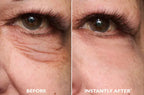 Findglee Eye Tightening Serum with Peptides for Puffiness, Wrinkles & Fine Lines