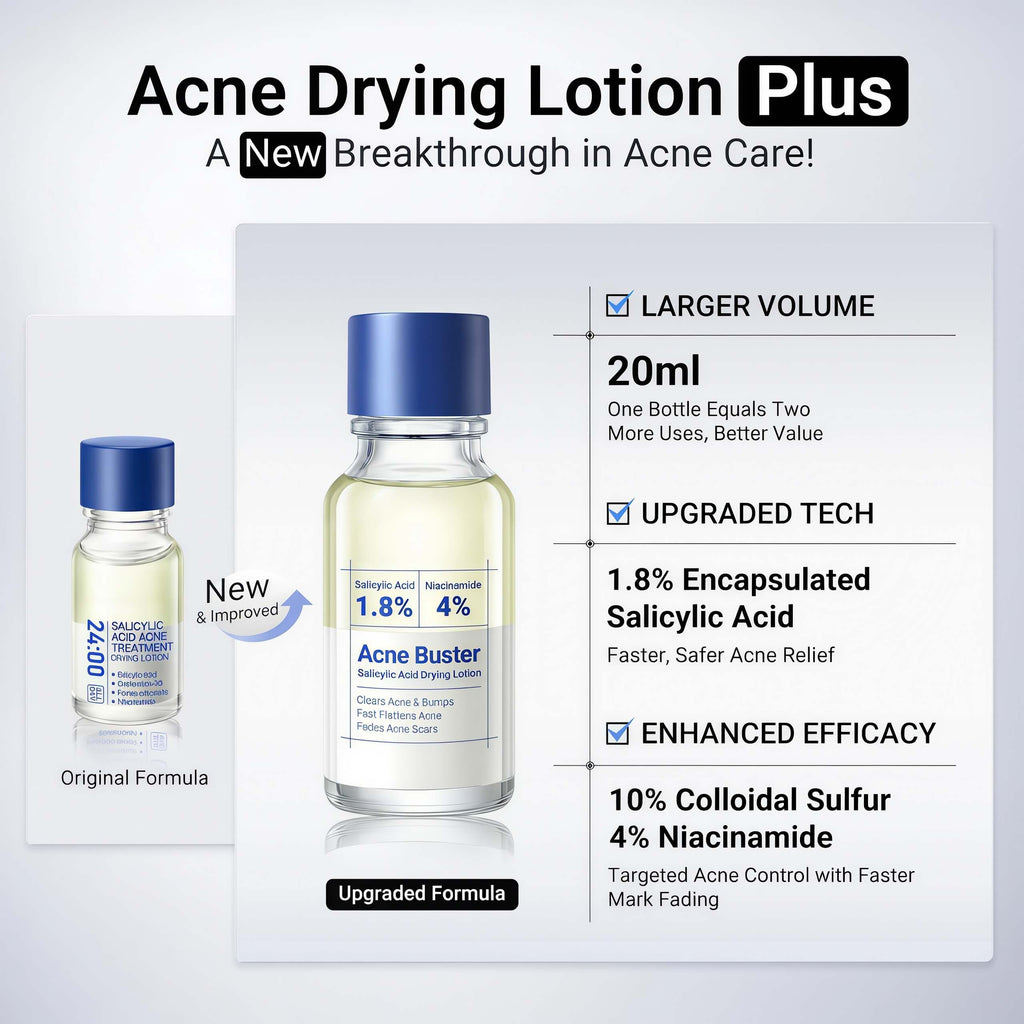 Acne Drying Lotion Plus - 3 Pack