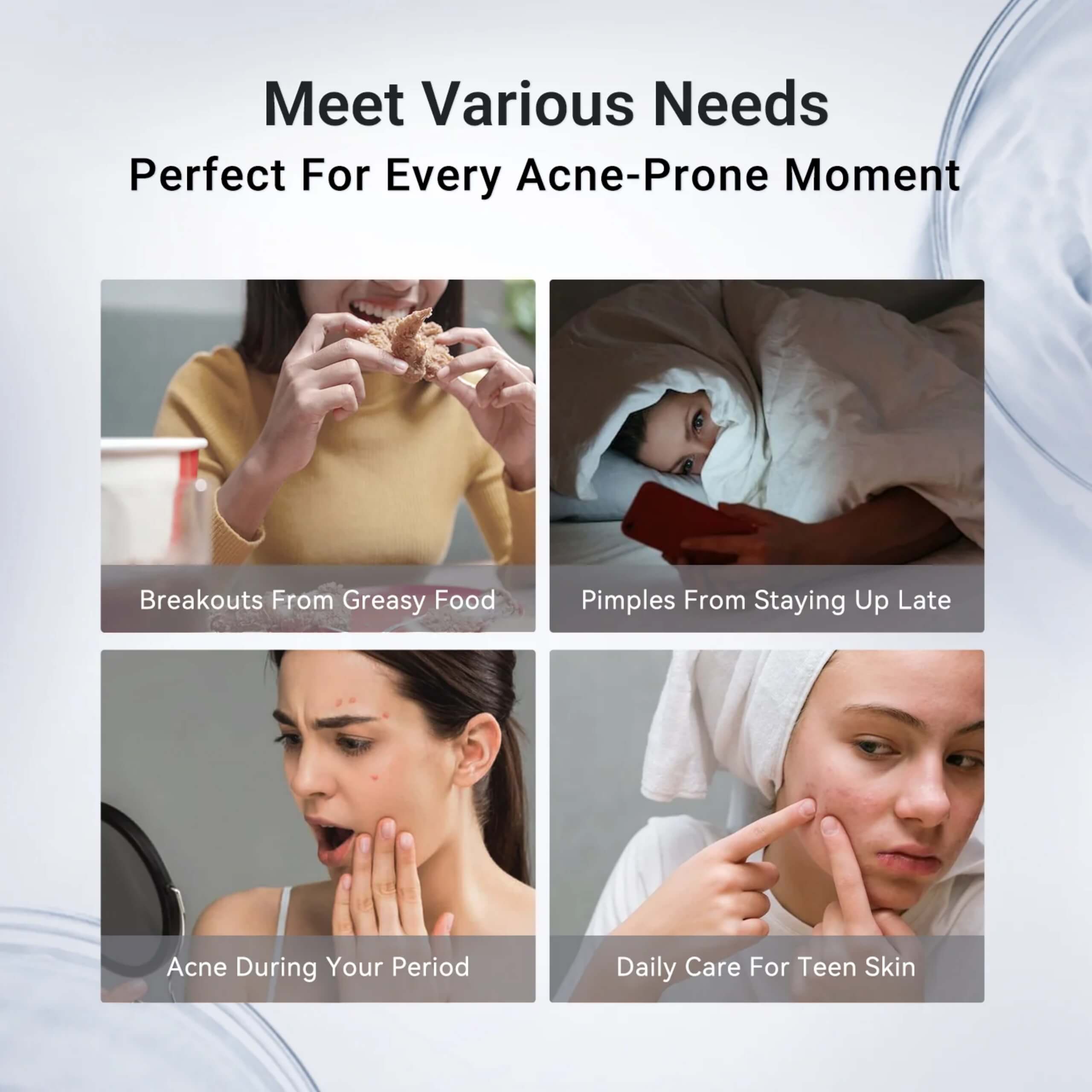 Acne Drying Lotion Plus - 3 Pack