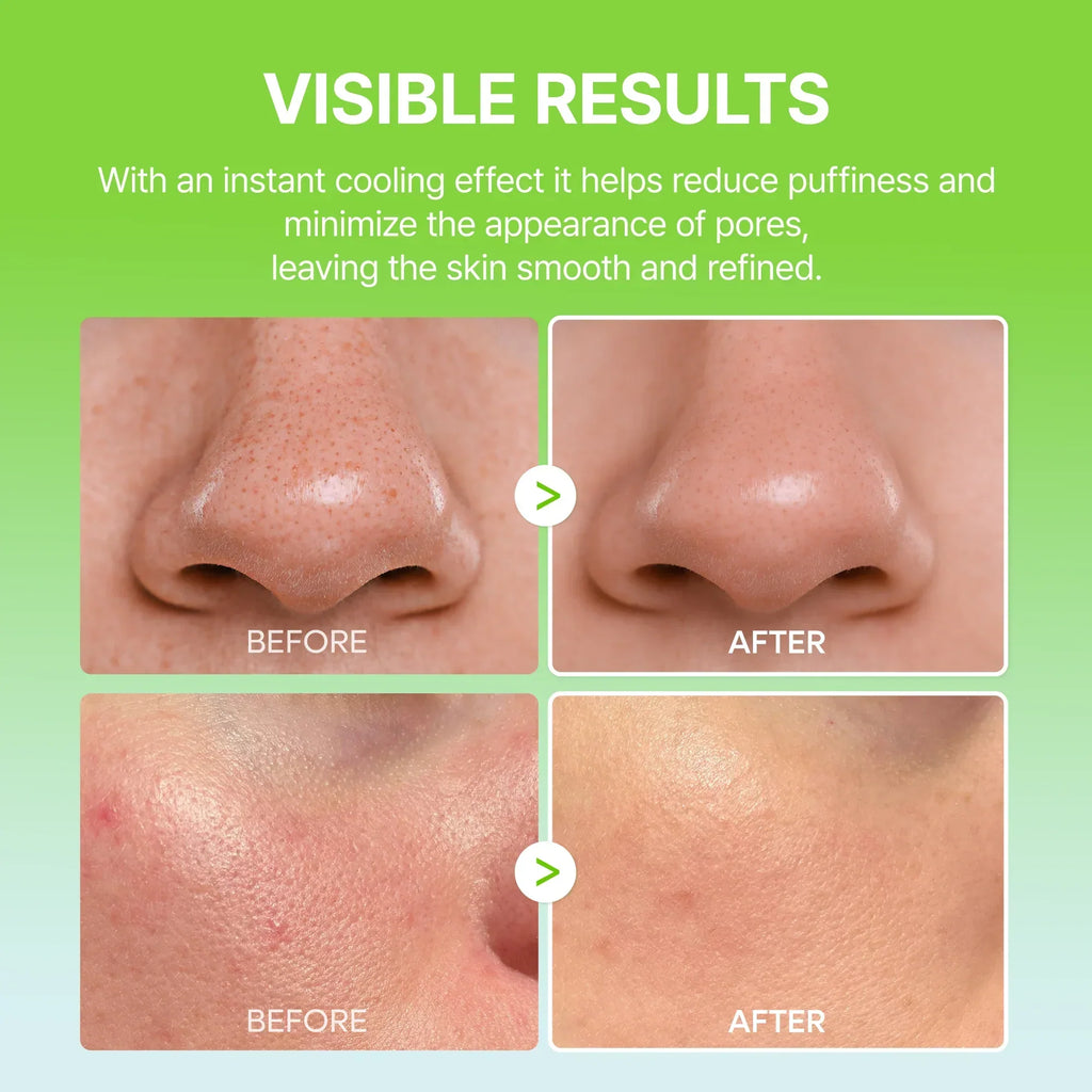 Findglee CACTOX Pore Relief Multi Balm for Pores, Puffiness & Skin Texture