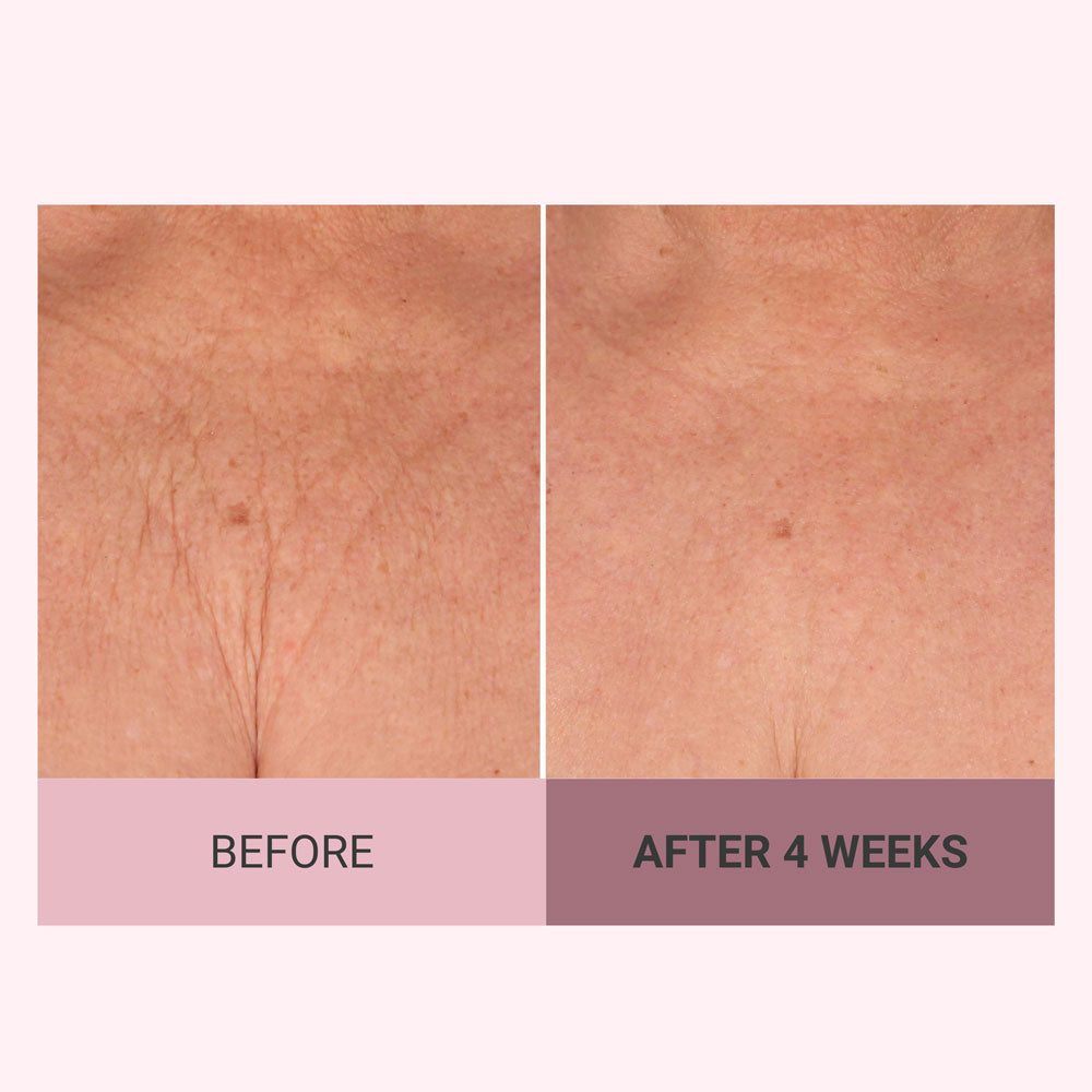 Findglee Champagne Firming Body Cream — Luxe-Lift Complex & Pink Pepperslim Firming Formula
