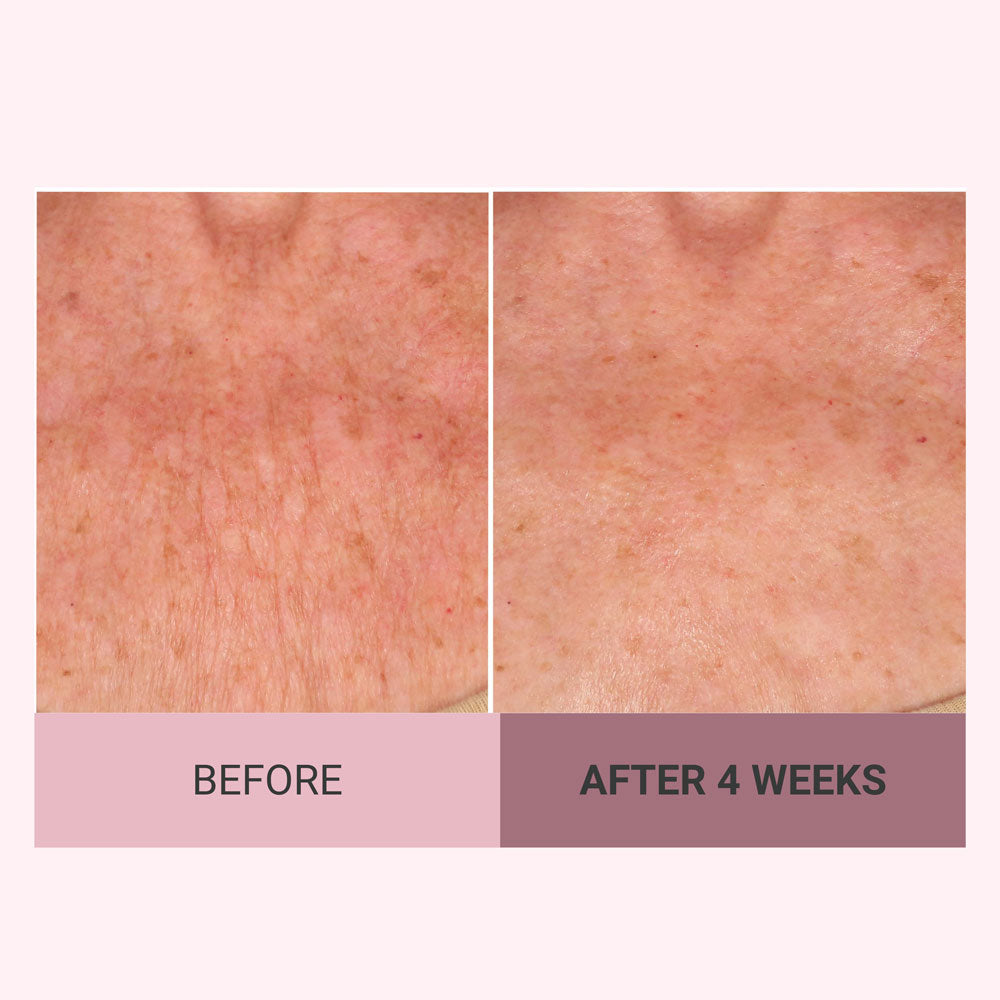 Findglee Champagne Firming Body Cream — Luxe-Lift Complex & Pink Pepperslim Firming Formula