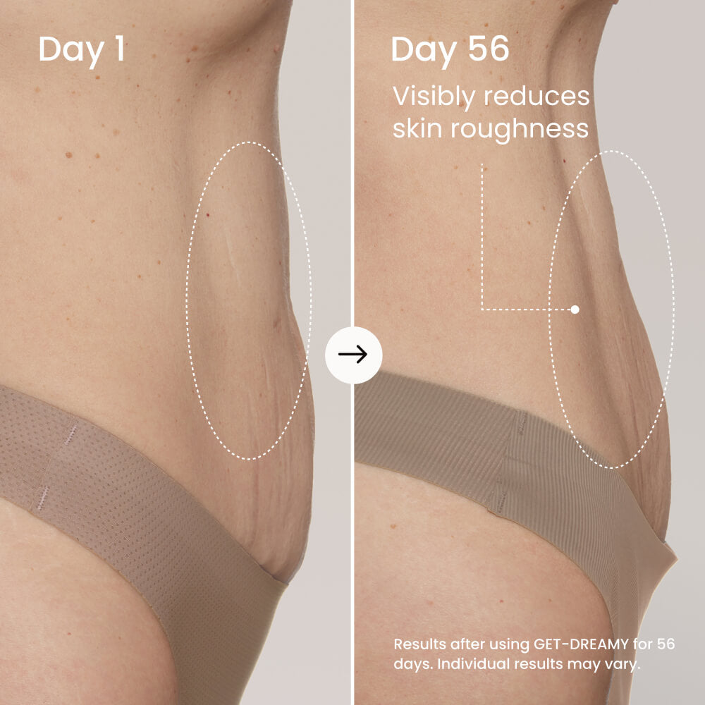 Findglee GET-DREAMY Overnight Body Whip with Caffeine, Peptides & Magnesium for Uneven Skin Texture