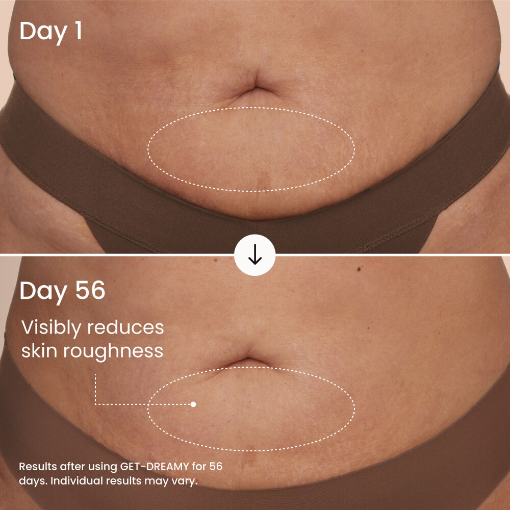 Findglee GET-DREAMY Overnight Body Whip with Caffeine, Peptides & Magnesium for Uneven Skin Texture