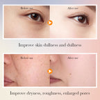 Findglee Korean 5X Vitamin C Skincare Set with Cleanser, Toner, Serum, Lotion, Eye and Face Cream
