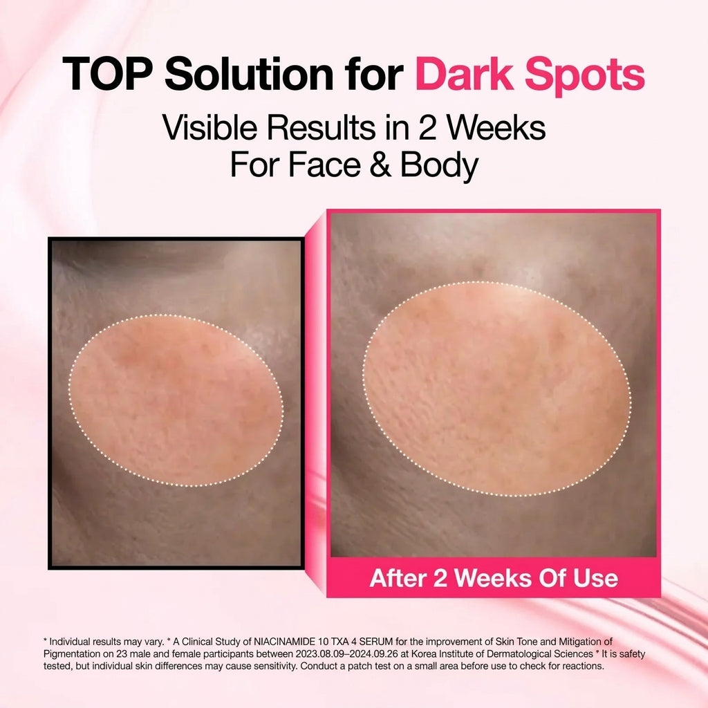 Findglee Dark Spot Brightening Serum with Niacinamide, Tranexamic Acid & Arbutin