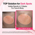 Findglee Dark Spot Brightening Serum with Niacinamide, Tranexamic Acid & Arbutin