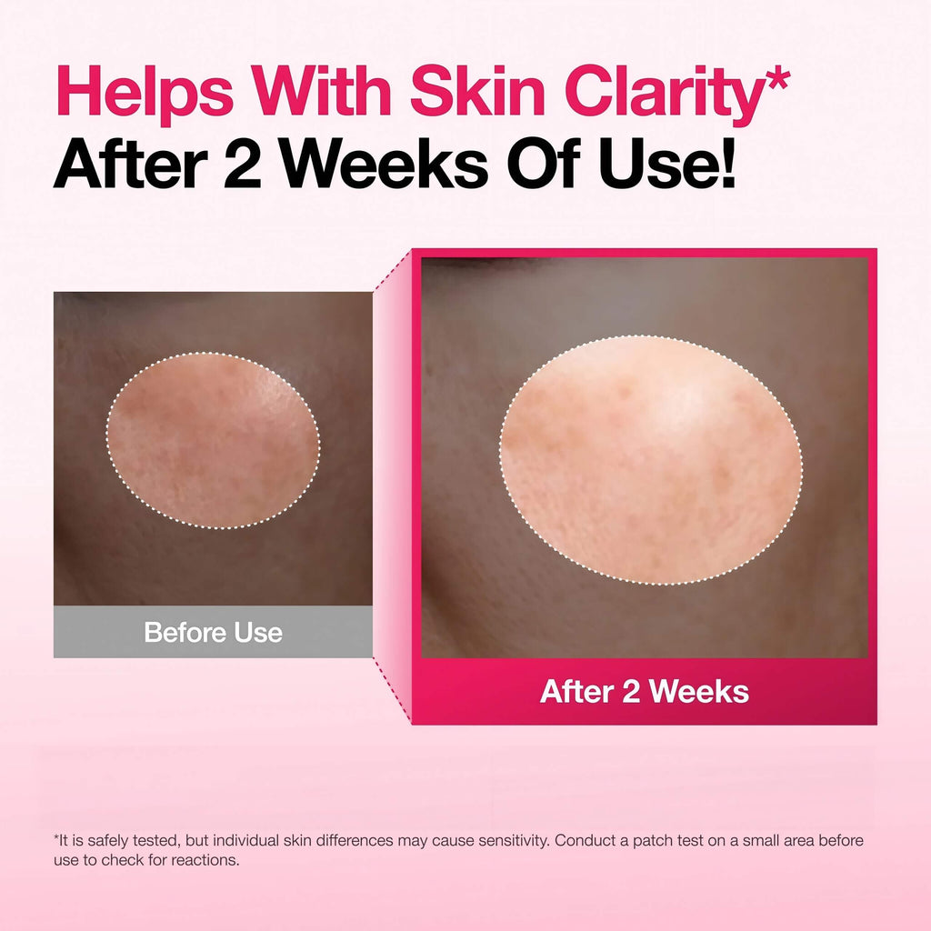Spotless Skin Duo