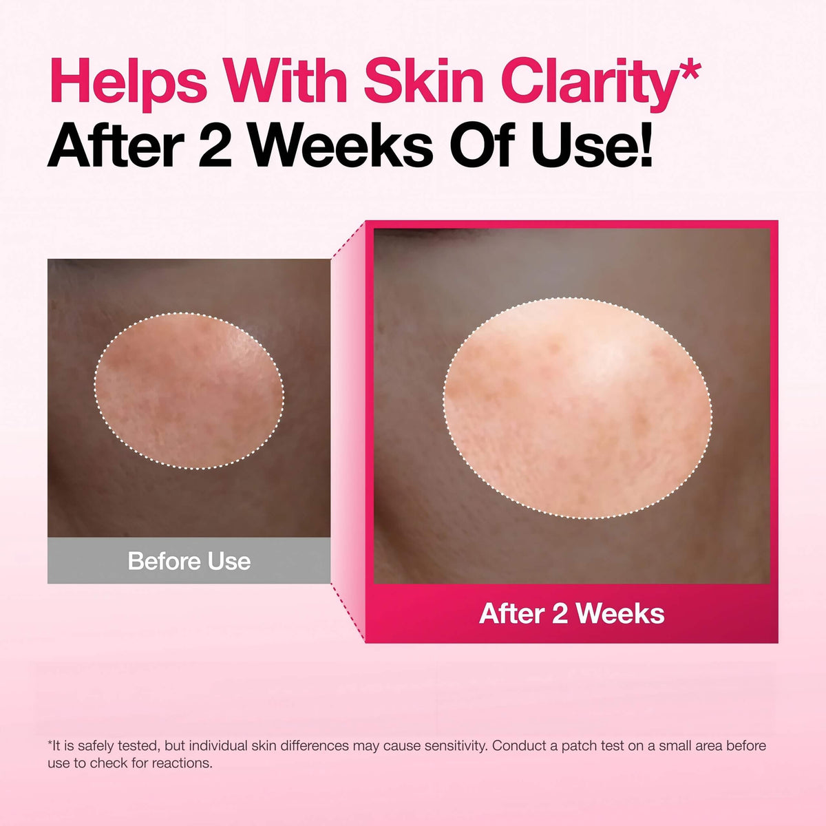 Spotless Skin Duo