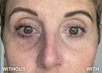 Findglee Luminous Eye Corrector Concealer SPF 41 with Peptides for Dark Circles, Fine Lines & Puffiness