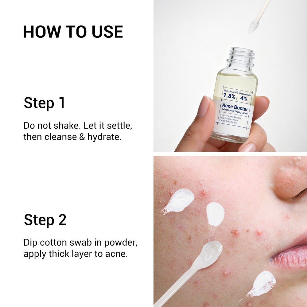 Findglee Salicylic Acid Drying Lotion with Niacinamide, Sulfur & Zinc Oxide for Acne