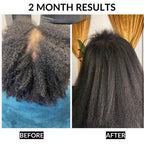 Findglee Healthy Hair Starter Kit 6-Piece Complete Hair Care Bundle for Stronger Hair