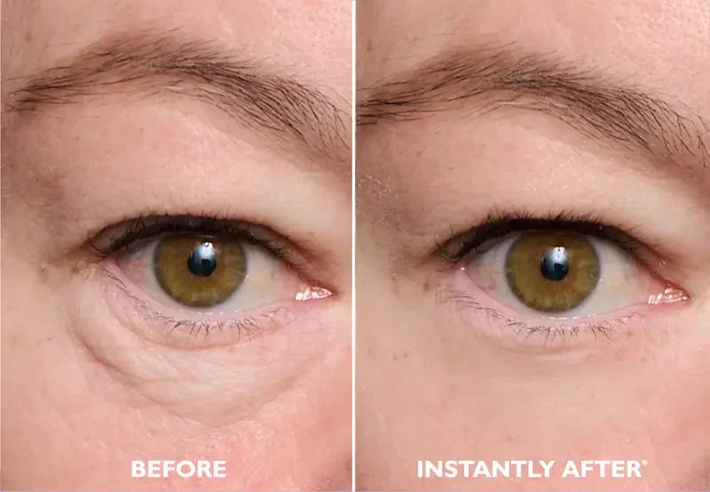 Findglee Eye Tightening Serum with Peptides for Puffiness, Wrinkles & Fine Lines