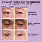 Findglee Eye Tightening Serum with Peptides for Puffiness, Wrinkles & Fine Lines