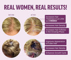Findglee Hair Growth Accelerator Biotin Supplement with Zinc for Thicker & Fuller Hair
