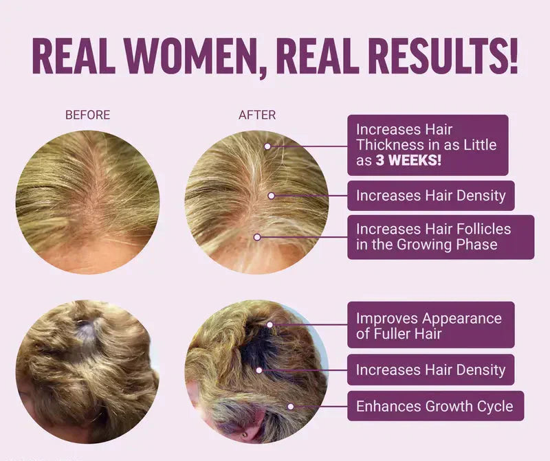 Findglee Hair Growth Accelerator Biotin Supplement with Zinc for Thicker & Fuller Hair