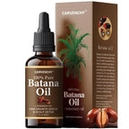 Findglee CARVENCHY Batana Oil with Rosemary Oil for Stronger, Healthier Hair